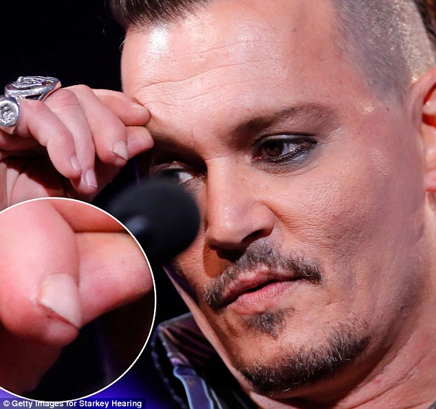 Cut Finger Depp Heard