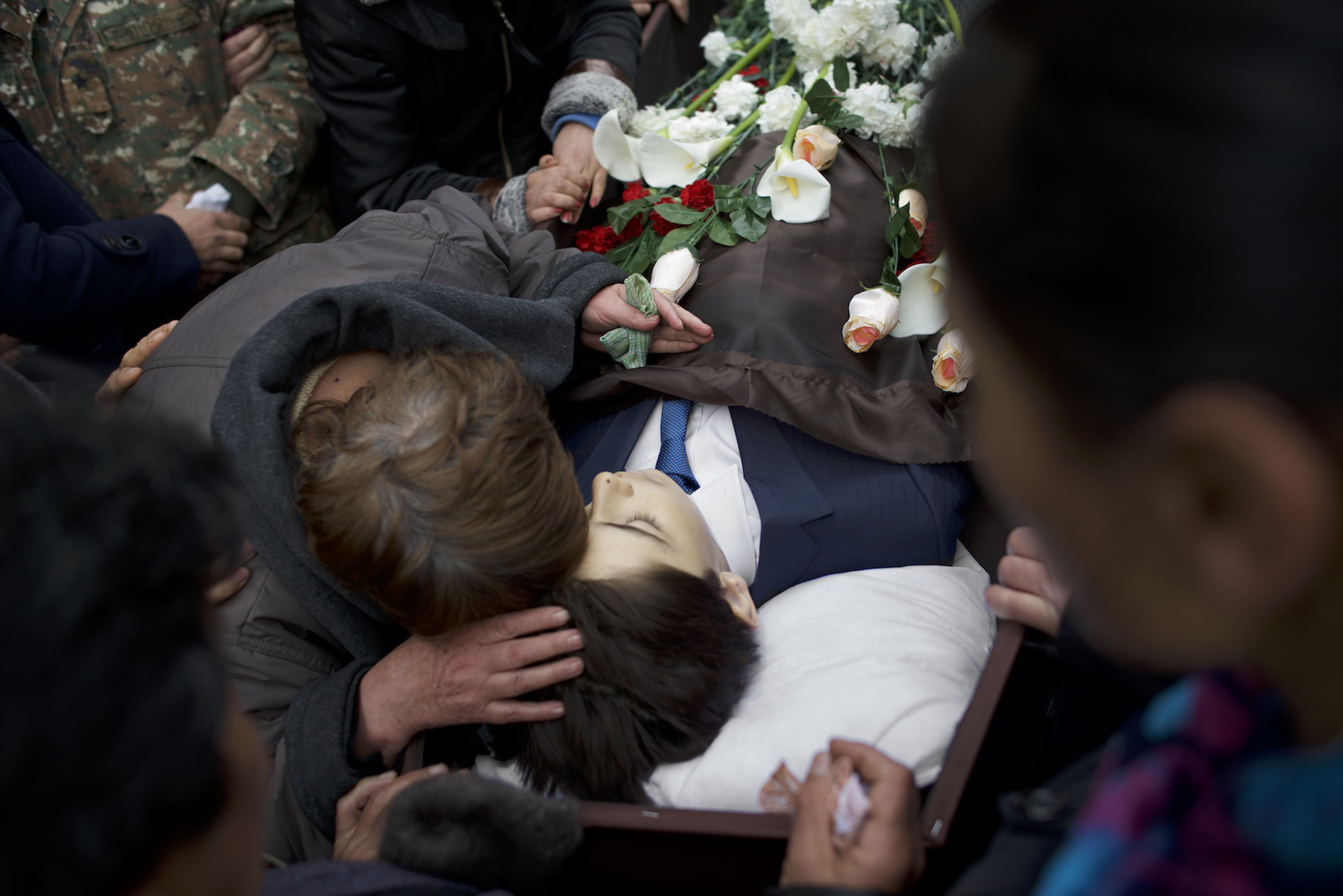 War Pain Nagorno Karabakh