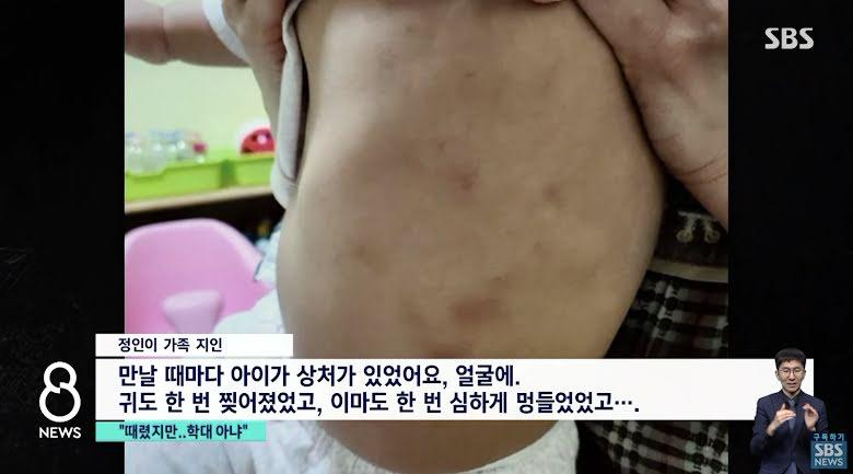 Jung In Lebam